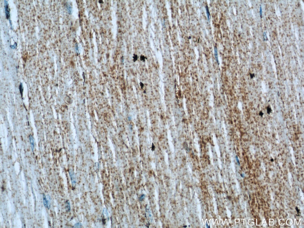 Immunohistochemistry (IHC) staining of human skeletal muscle tissue using SAR1A Polyclonal antibody (15350-1-AP)