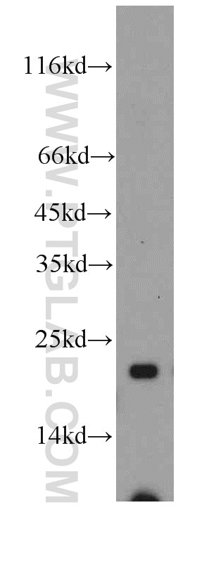 Western Blot (WB) analysis of mouse liver tissue using SAR1A Polyclonal antibody (15350-1-AP)