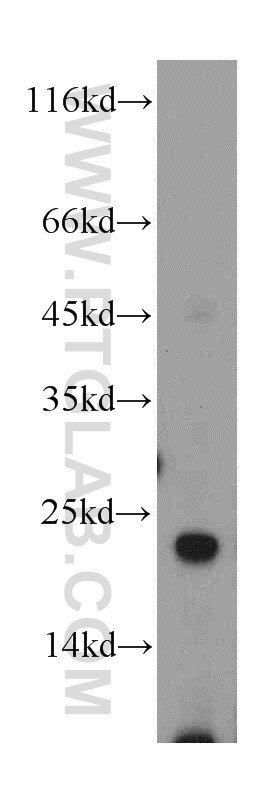 Western Blot (WB) analysis of HT-1080 cells using SAR1A Polyclonal antibody (15350-1-AP)