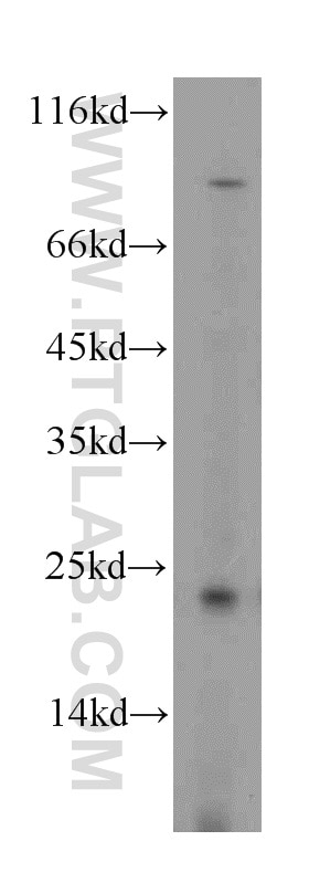 Western Blot (WB) analysis of HT-1080 cells using SAR1A Polyclonal antibody (15350-1-AP)