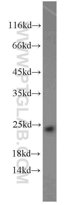 Western Blot (WB) analysis of HeLa cells using SAR1A Polyclonal antibody (15350-1-AP)
