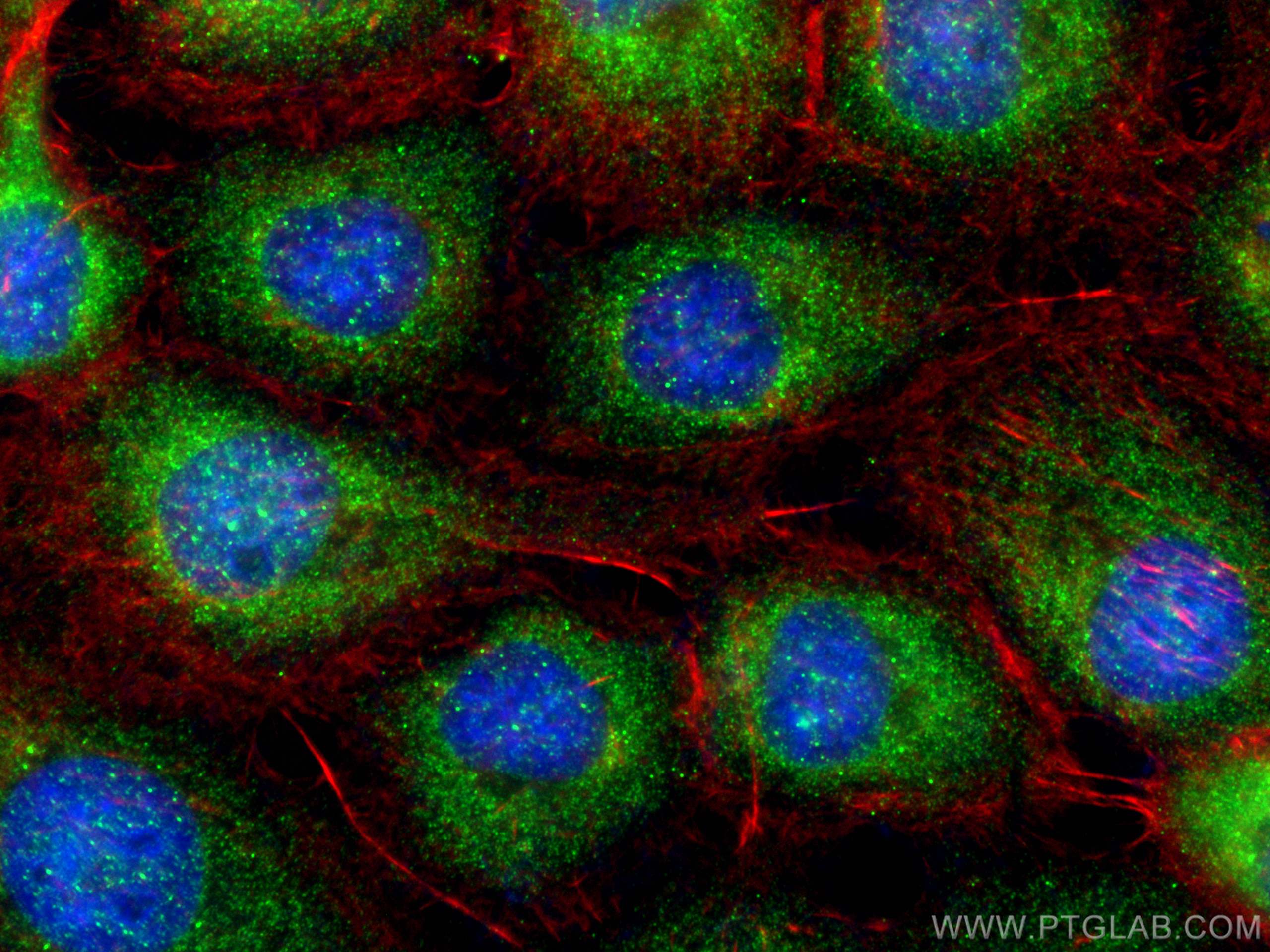 Immunofluorescence (IF) / fluorescent staining of A431 cells using SAR1A Polyclonal antibody (22291-1-AP)