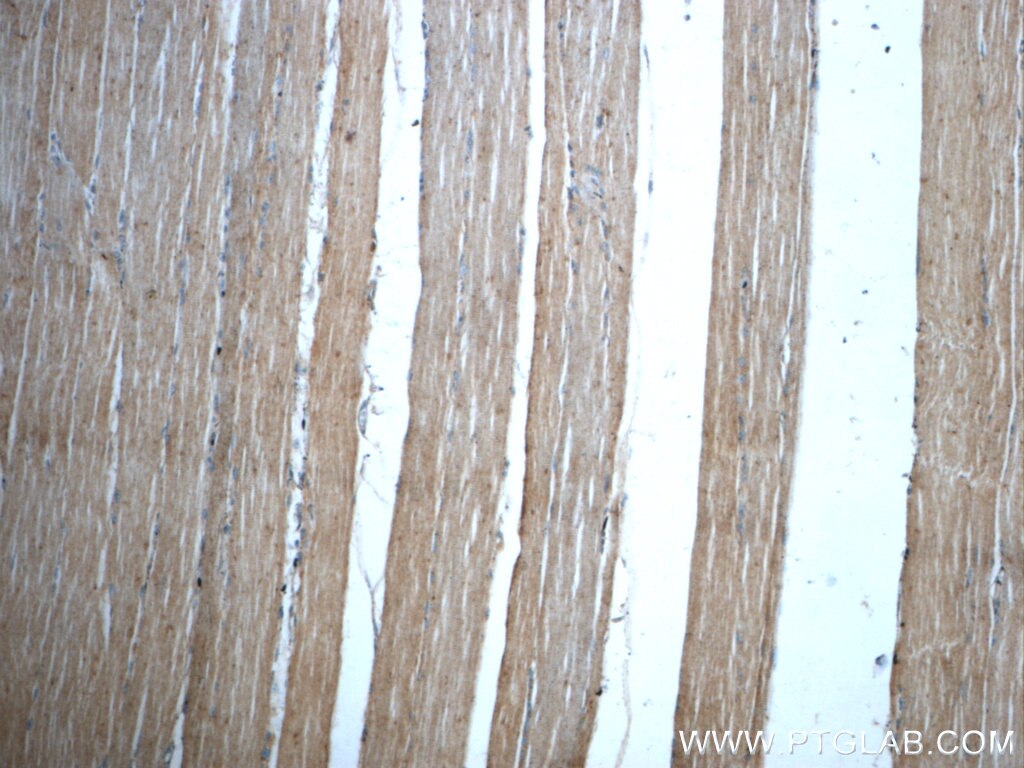 Immunohistochemistry (IHC) staining of human skeletal muscle tissue using SAR1A Polyclonal antibody (22291-1-AP)