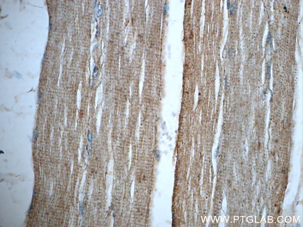 Immunohistochemistry (IHC) staining of human skeletal muscle tissue using SAR1A Polyclonal antibody (22291-1-AP)