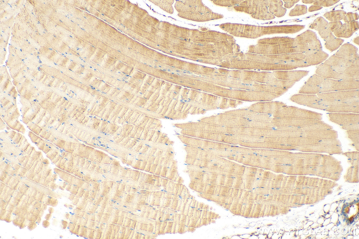 Immunohistochemistry (IHC) staining of mouse skeletal muscle tissue using SAR1A Polyclonal antibody (22291-1-AP)