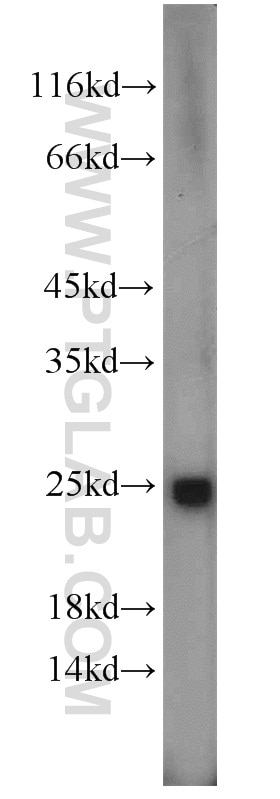 Western Blot (WB) analysis of HT-1080 cells using SAR1A Polyclonal antibody (22291-1-AP)