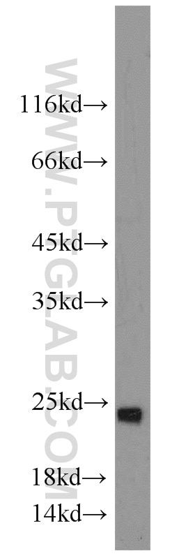 Western Blot (WB) analysis of HepG2 cells using SAR1A Polyclonal antibody (22291-1-AP)