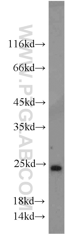 Western Blot (WB) analysis of mouse kidney tissue using SAR1A Polyclonal antibody (22291-1-AP)