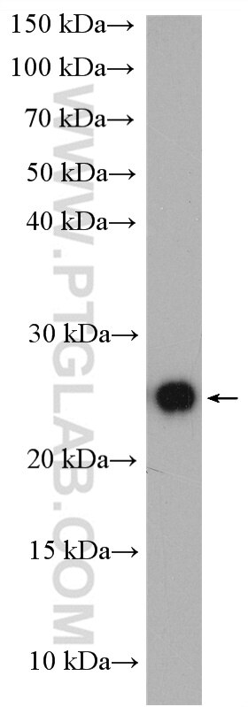 Western Blot (WB) analysis of mouse brain tissue using SAR1B Polyclonal antibody (15453-1-AP)