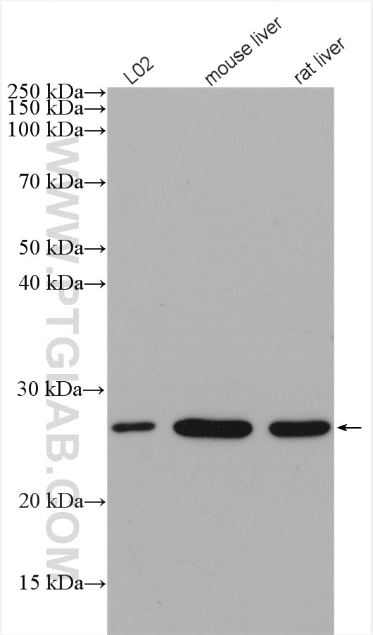 Western Blot (WB) analysis of various lysates using SAR1B Polyclonal antibody (15453-1-AP)
