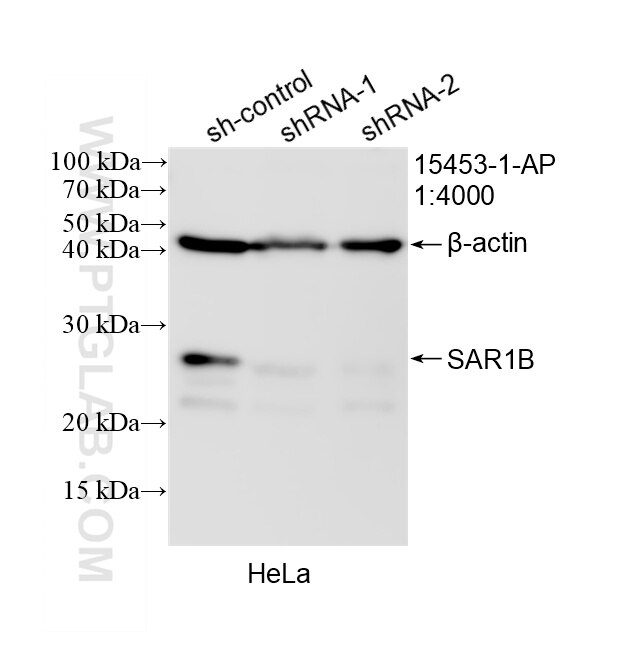 Western Blot (WB) analysis of HeLa cells using SAR1B Polyclonal antibody (15453-1-AP)