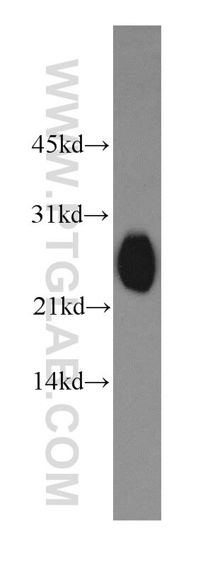 Western Blot (WB) analysis of human liver tissue using SAR1B Polyclonal antibody (15453-1-AP)