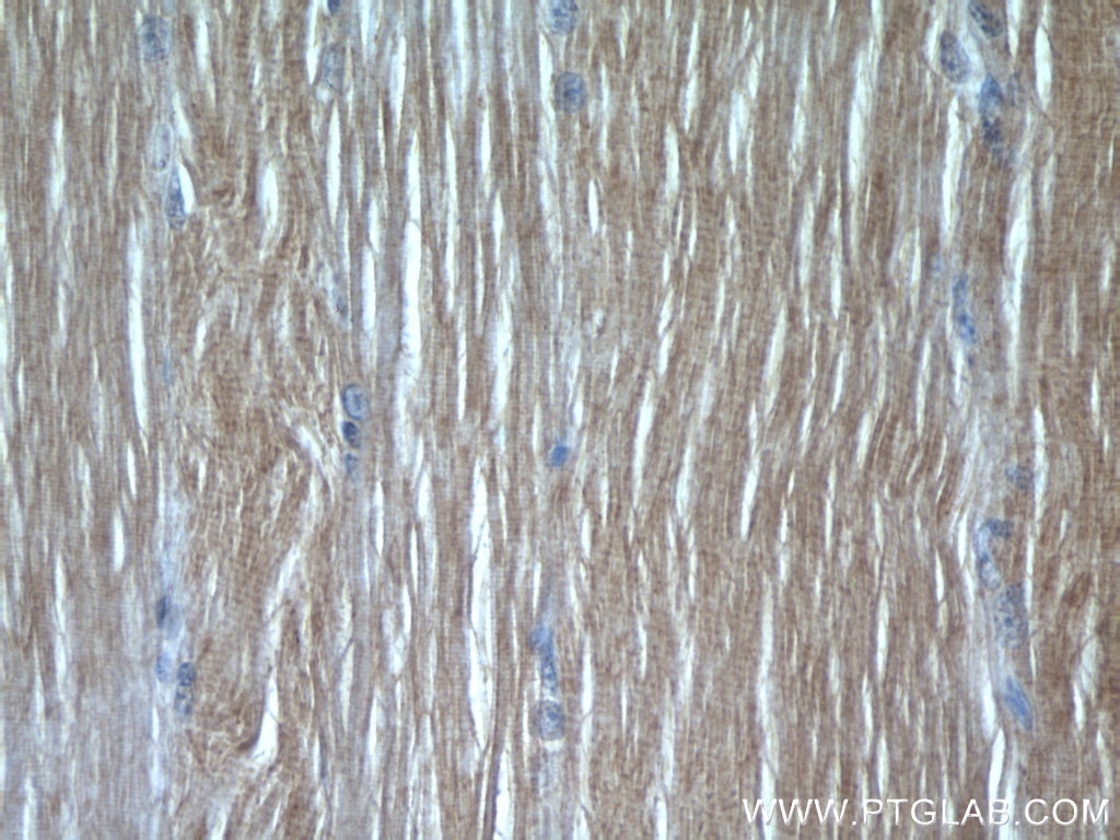 Immunohistochemistry (IHC) staining of human skeletal muscle tissue using SAR1B Polyclonal antibody (22292-1-AP)