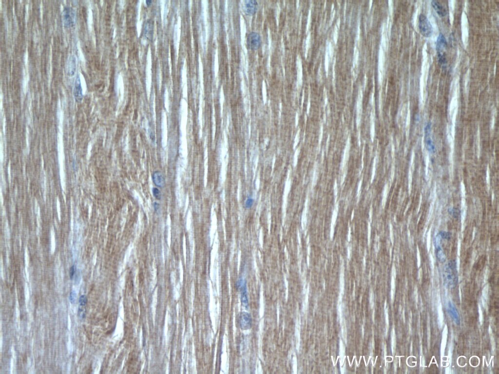 IHC staining of human skeletal muscle using 22292-1-AP