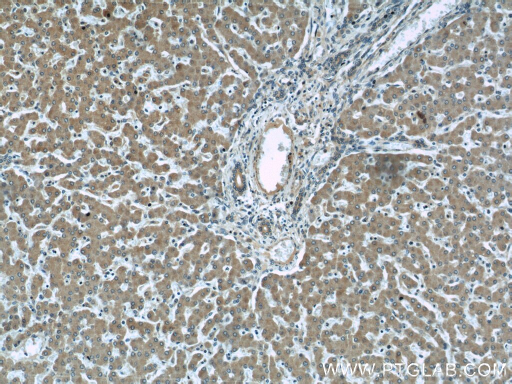 Immunohistochemistry (IHC) staining of human liver tissue using SAR1B Polyclonal antibody (22292-1-AP)