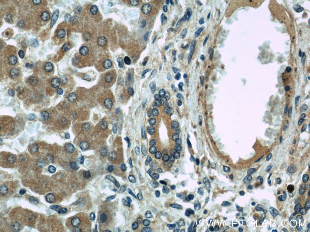 Immunohistochemistry (IHC) staining of human liver tissue using SAR1B Polyclonal antibody (22292-1-AP)