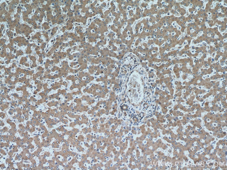 Immunohistochemistry (IHC) staining of human liver tissue using SAR1B Polyclonal antibody (22292-1-AP)