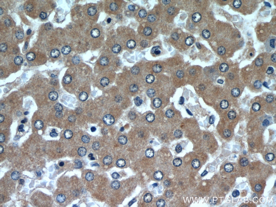 Immunohistochemistry (IHC) staining of human liver tissue using SAR1B Polyclonal antibody (22292-1-AP)