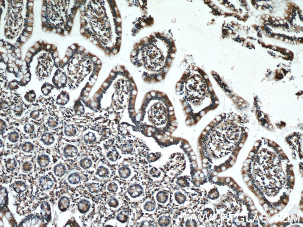 Immunohistochemistry (IHC) staining of human small intestine tissue using SAR1B Polyclonal antibody (22292-1-AP)