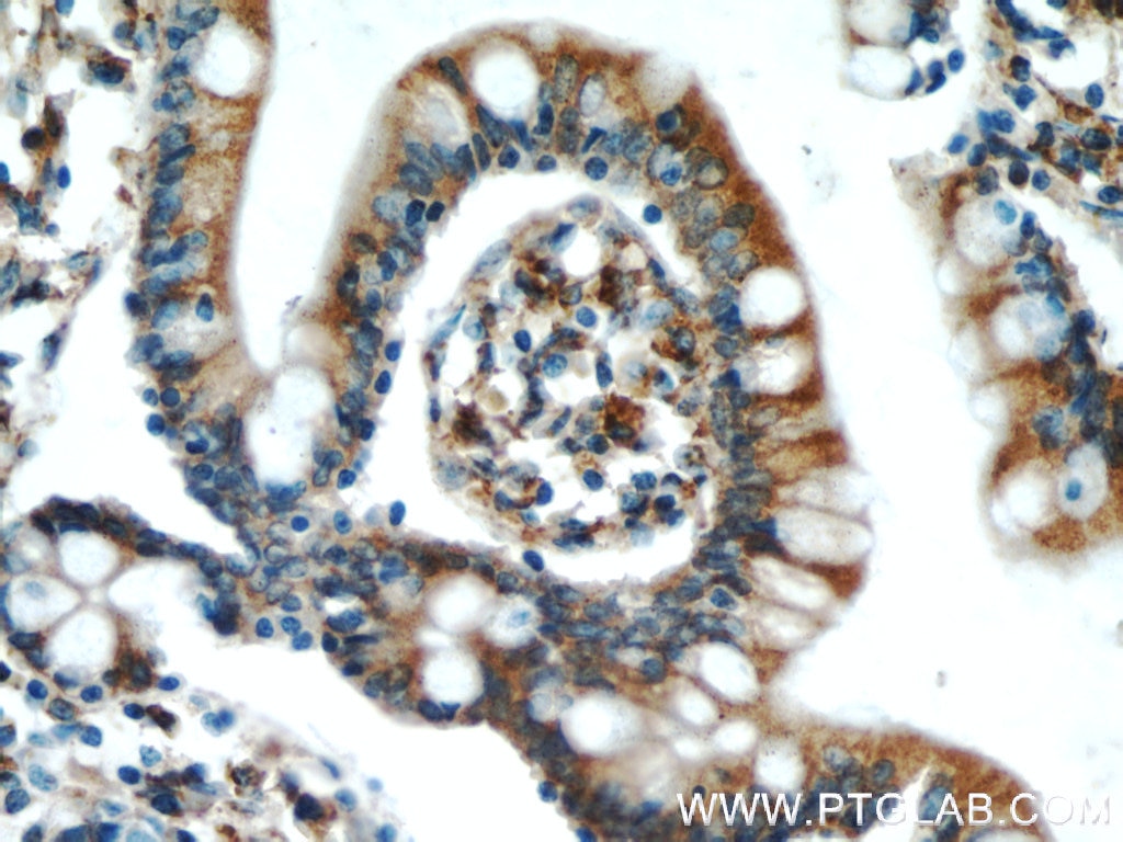 Immunohistochemistry (IHC) staining of human small intestine tissue using SAR1B Polyclonal antibody (22292-1-AP)