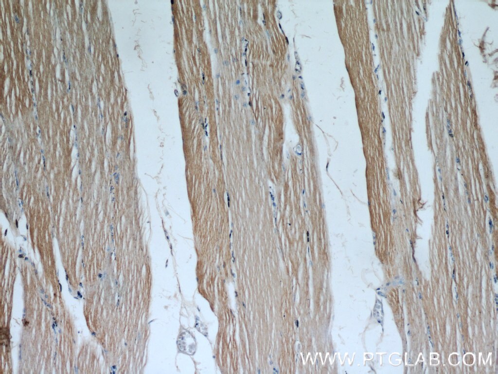 Immunohistochemistry (IHC) staining of human skeletal muscle tissue using SAR1B Polyclonal antibody (22292-1-AP)