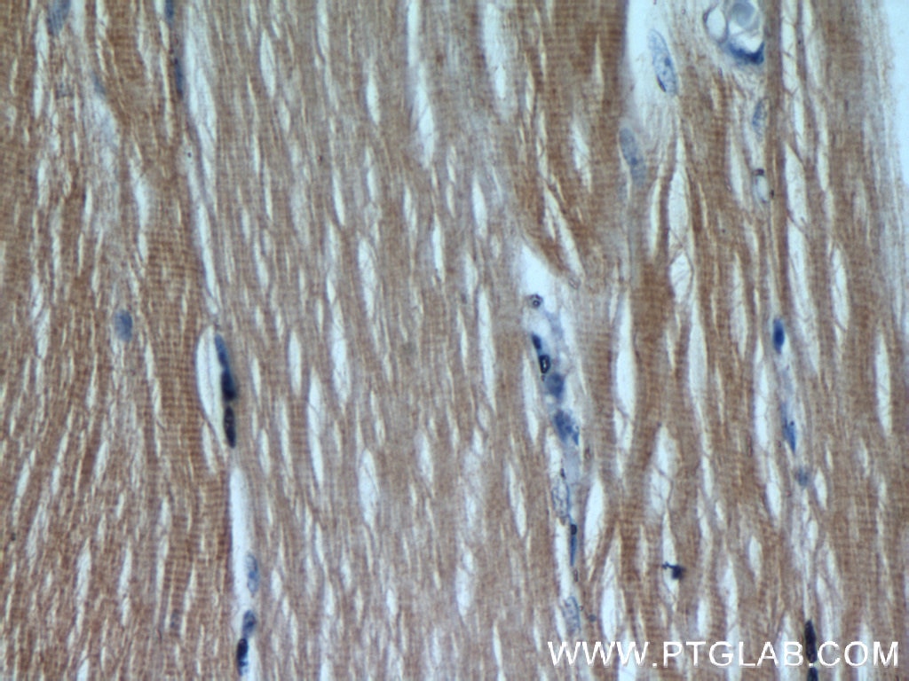 Immunohistochemistry (IHC) staining of human skeletal muscle tissue using SAR1B Polyclonal antibody (22292-1-AP)