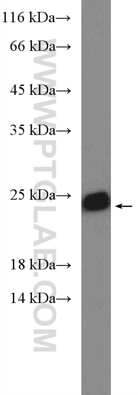 Western Blot (WB) analysis of mouse liver tissue using SAR1B Polyclonal antibody (22292-1-AP)