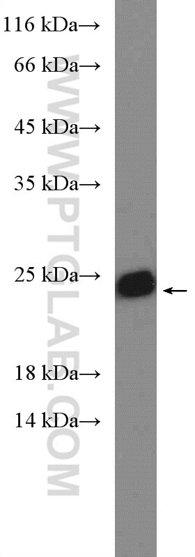 Western Blot (WB) analysis of mouse liver tissue using SAR1B Polyclonal antibody (22292-1-AP)