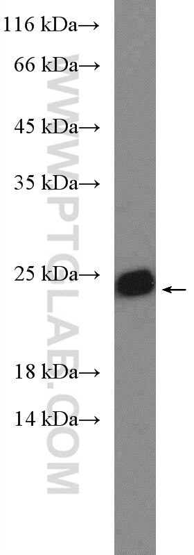 WB analysis of mouse liver using 22292-1-AP