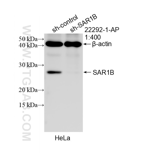 Western Blot (WB) analysis of HeLa cells using SAR1B Polyclonal antibody (22292-1-AP)