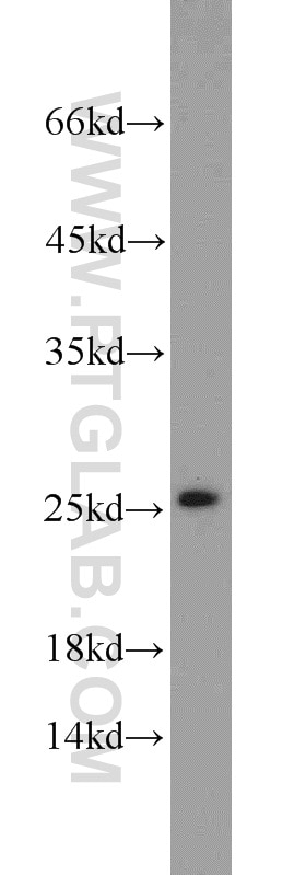 Western Blot (WB) analysis of mouse liver tissue using SAR1B Polyclonal antibody (22292-1-AP)