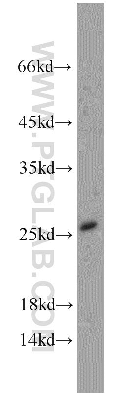 Western Blot (WB) analysis of mouse small intestine tissue using SAR1B Polyclonal antibody (22292-1-AP)