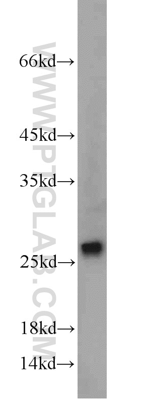 Western Blot (WB) analysis of mouse skeletal muscle tissue using SAR1B Polyclonal antibody (22292-1-AP)