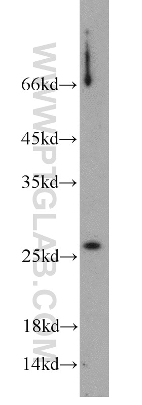 Western Blot (WB) analysis of RAW264.7 using SAR1B Polyclonal antibody (22292-1-AP)