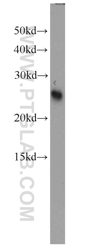 Western Blot (WB) analysis of mouse brain tissue using SAR1B Polyclonal antibody (22292-1-AP)
