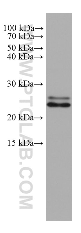 Western Blot (WB) analysis of HeLa cells using SAR1B Monoclonal antibody (67765-1-Ig)