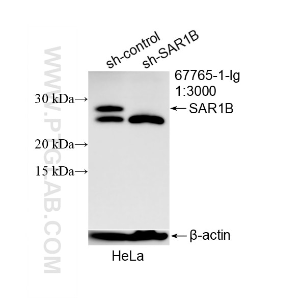 Western Blot (WB) analysis of HeLa cells using SAR1B Monoclonal antibody (67765-1-Ig)