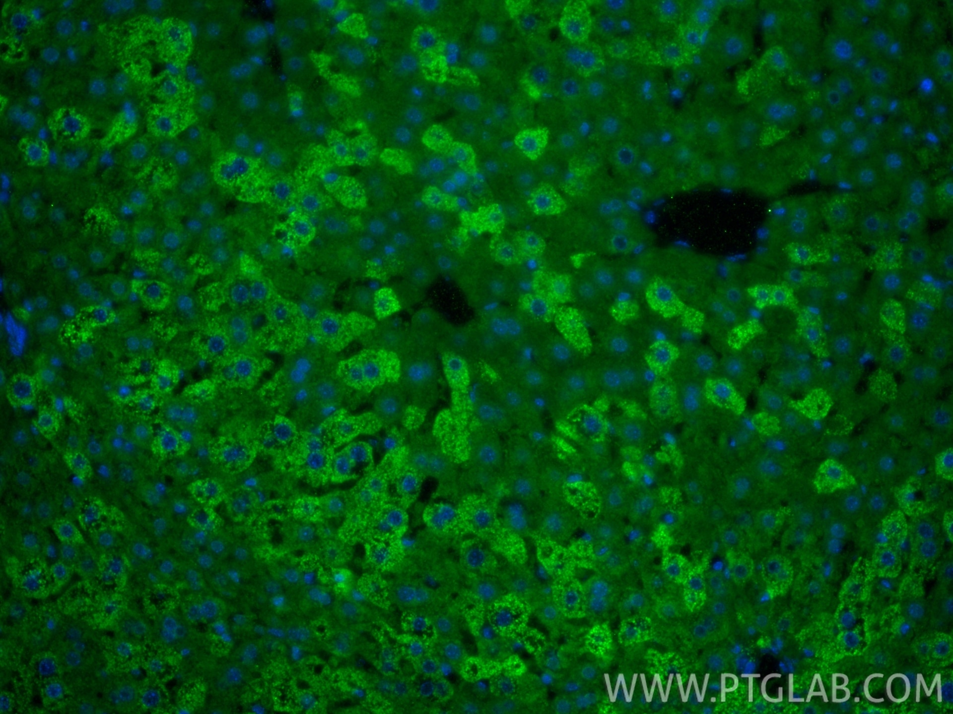 IF Staining of mouse liver using 22762-1-AP Immunofluorescence (IF) / fluorescent staining of mouse liver tissue using SARDH Polyclonal antibody (22762-1-AP)