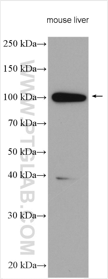 Western Blot (WB) analysis of various lysates using SARDH Polyclonal antibody (22762-1-AP)