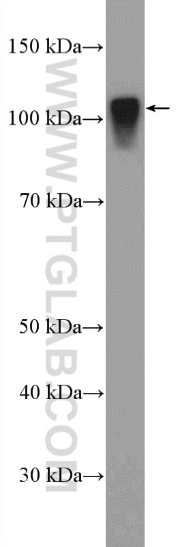 Western Blot (WB) analysis of rat liver tissue using SARDH Polyclonal antibody (22762-1-AP)