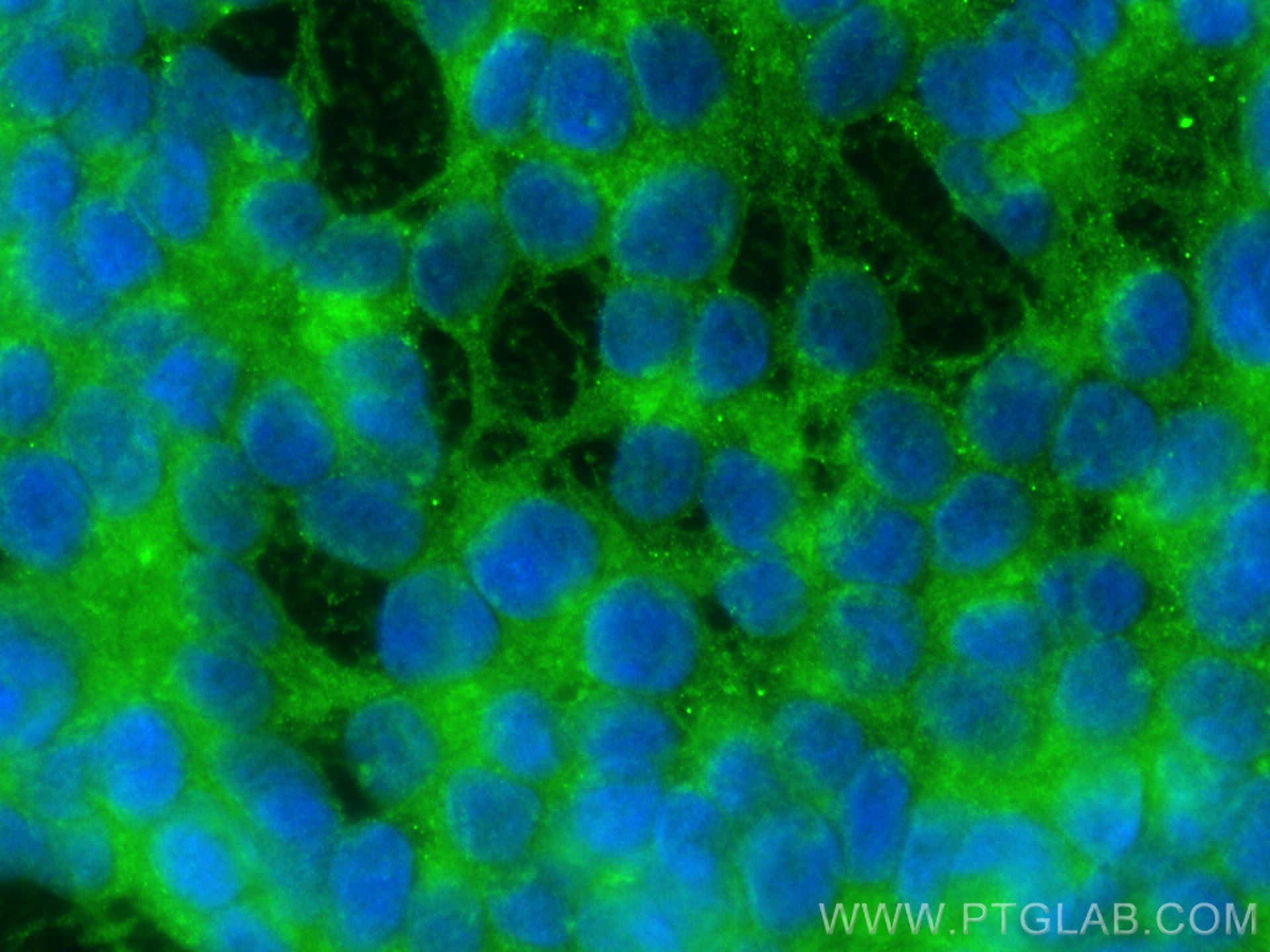 Immunofluorescence (IF) / fluorescent staining of SH-SY5Y cells using SARM1 Polyclonal antibody (28625-1-AP)