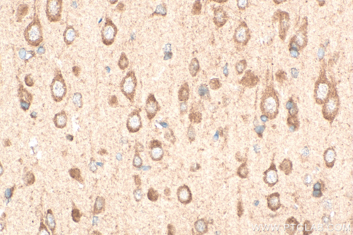 Immunohistochemistry (IHC) staining of rat brain tissue using SARM1 Polyclonal antibody (28625-1-AP)