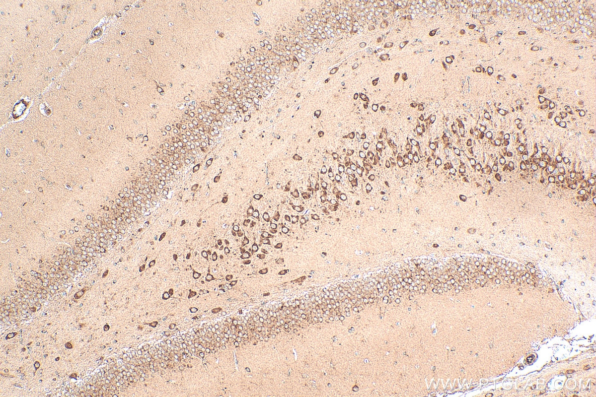 Immunohistochemistry (IHC) staining of rat brain tissue using SARM1 Polyclonal antibody (28625-1-AP)