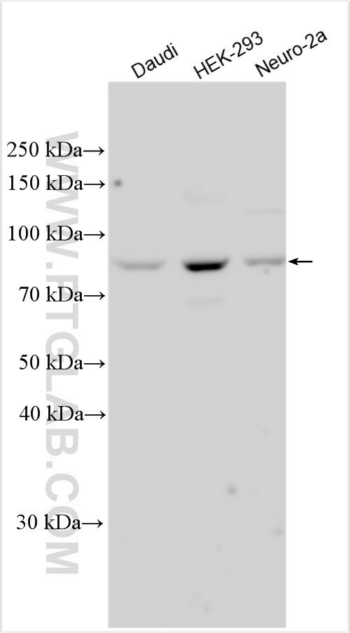 Western Blot (WB) analysis of various lysates using SARM1 Polyclonal antibody (28625-1-AP)