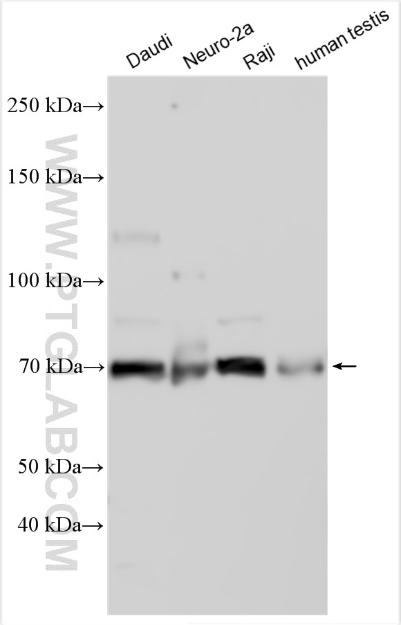 Western Blot (WB) analysis of various lysates using SARM1 Polyclonal antibody (28625-1-AP)