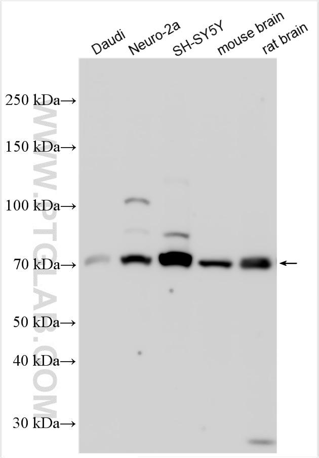 Western Blot (WB) analysis of various lysates using SARM1 Polyclonal antibody (28625-1-AP)