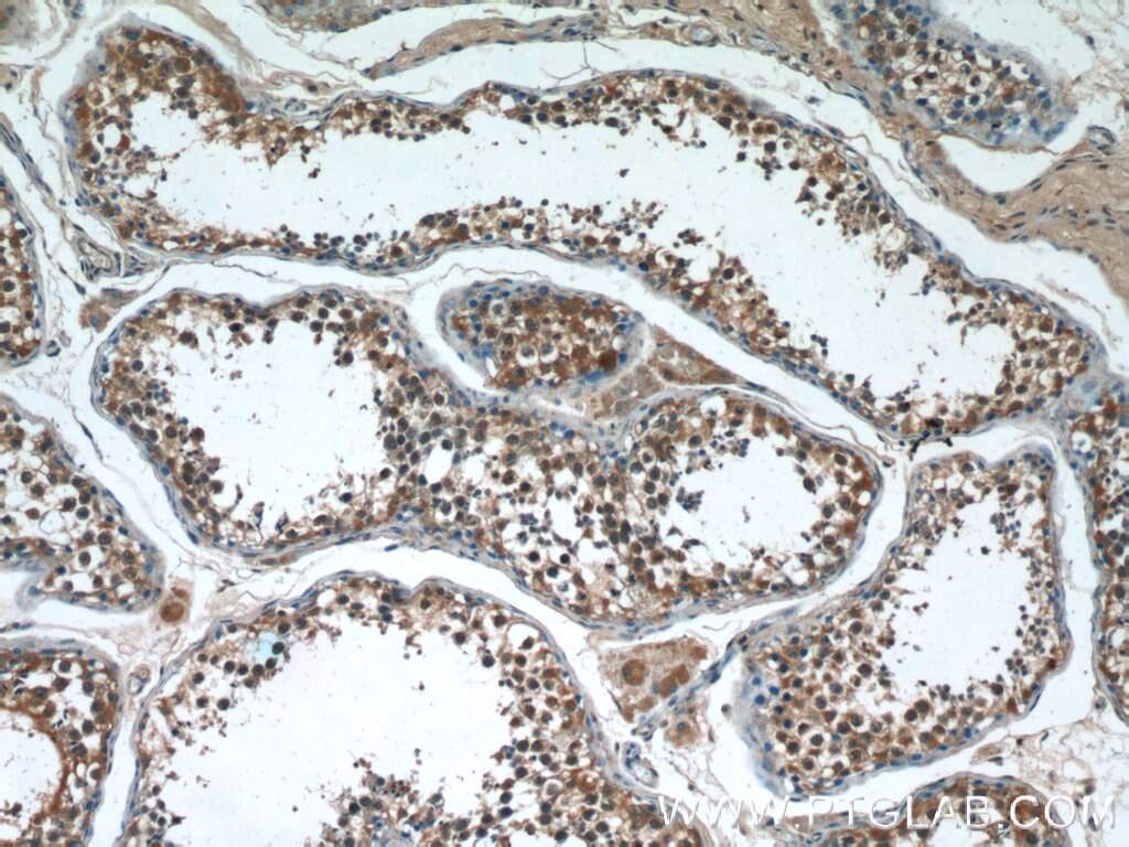Immunohistochemistry (IHC) staining of human testis tissue using SARM1 Polyclonal antibody (55488-1-AP)