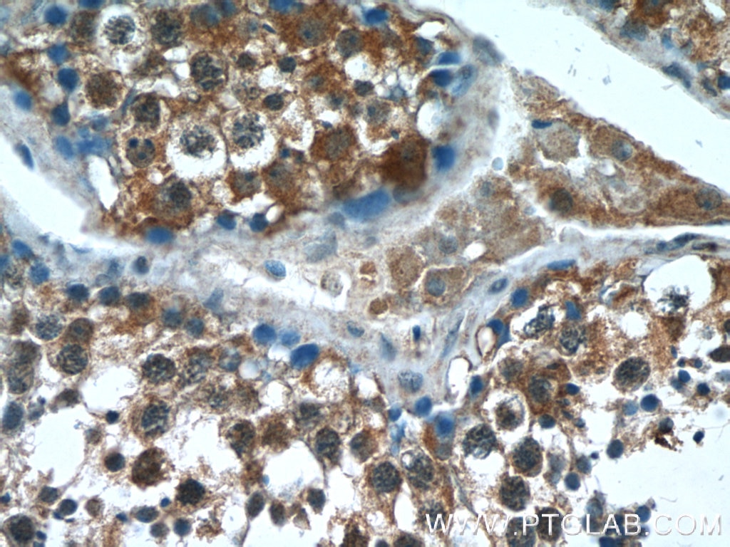 Immunohistochemistry (IHC) staining of human testis tissue using SARM1 Polyclonal antibody (55488-1-AP)