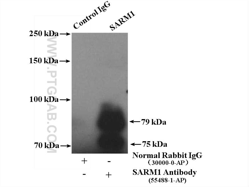 Immunoprecipitation (IP) experiment of A431 cells using SARM1 Polyclonal antibody (55488-1-AP)