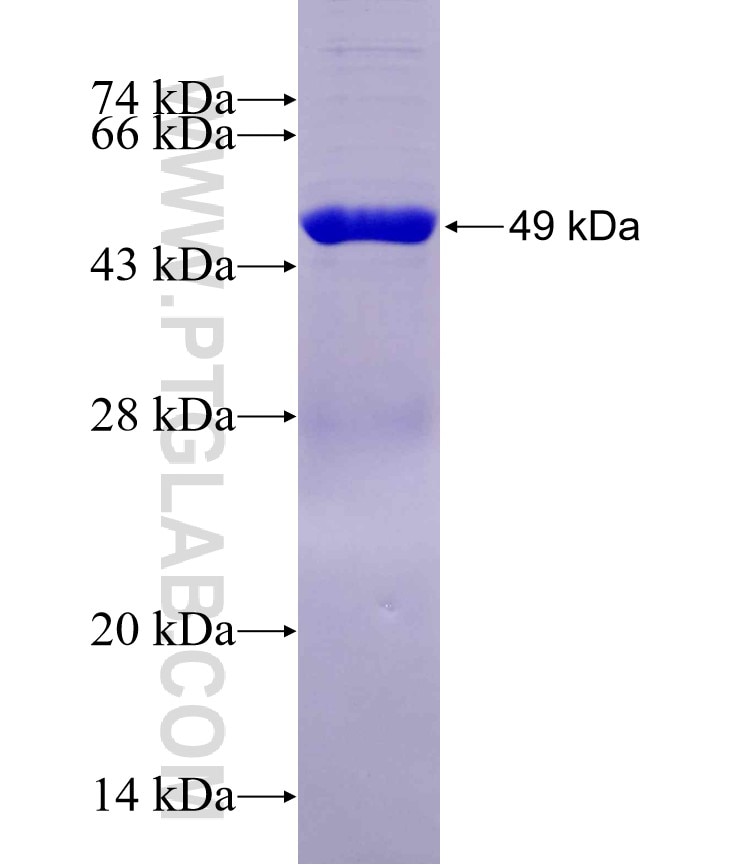 SARM1 fusion protein Ag29531 SDS-PAGE